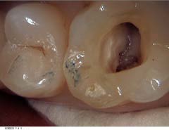 Moderne Endodontie3