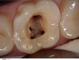 Moderne Endodontie5