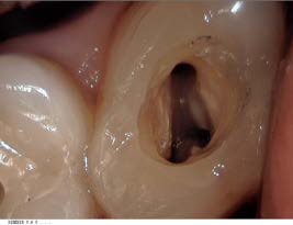 Moderne Endodontie6