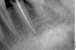 Moderne Endodontie7