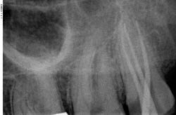 Moderne Endodontie8