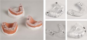 Bohrschablonen Beispiel